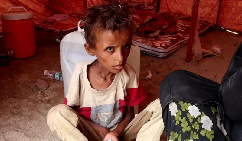أطفال النازحين في مخيم الفردوس بعدن.. سوء تغذية ورعاية طبية متواصلة